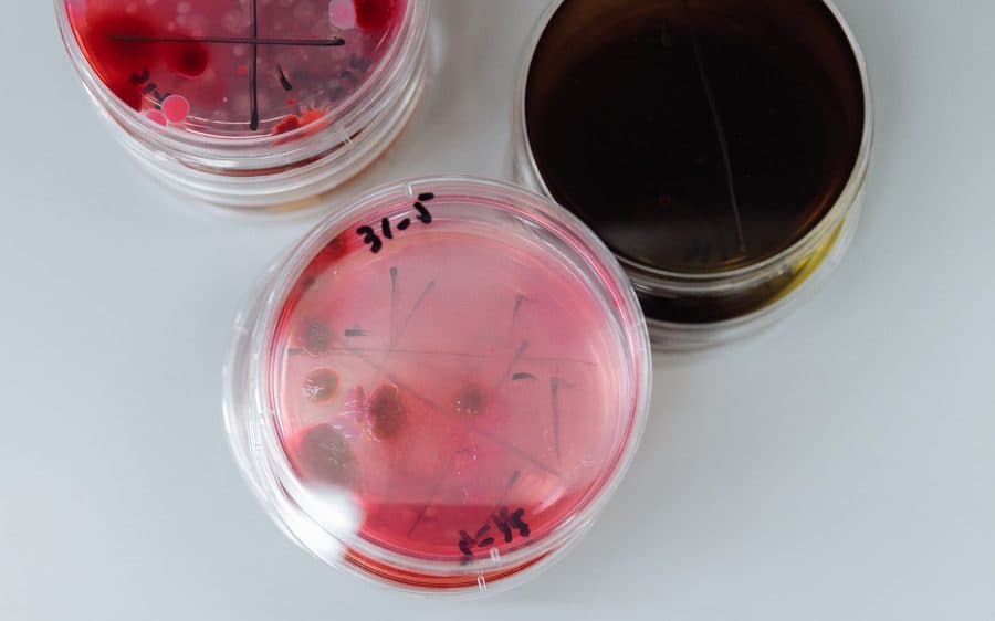 Labelled petri dishes with cultured microbial colonies
